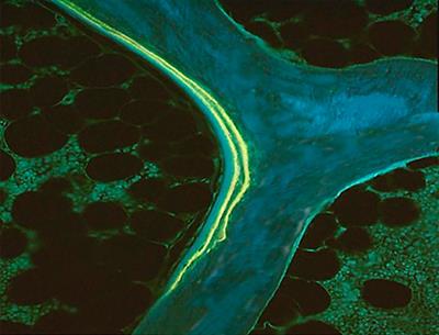 Interest of Bone Histomorphometry in Bone Pathophysiology Investigation: Foundation, Present, and Future